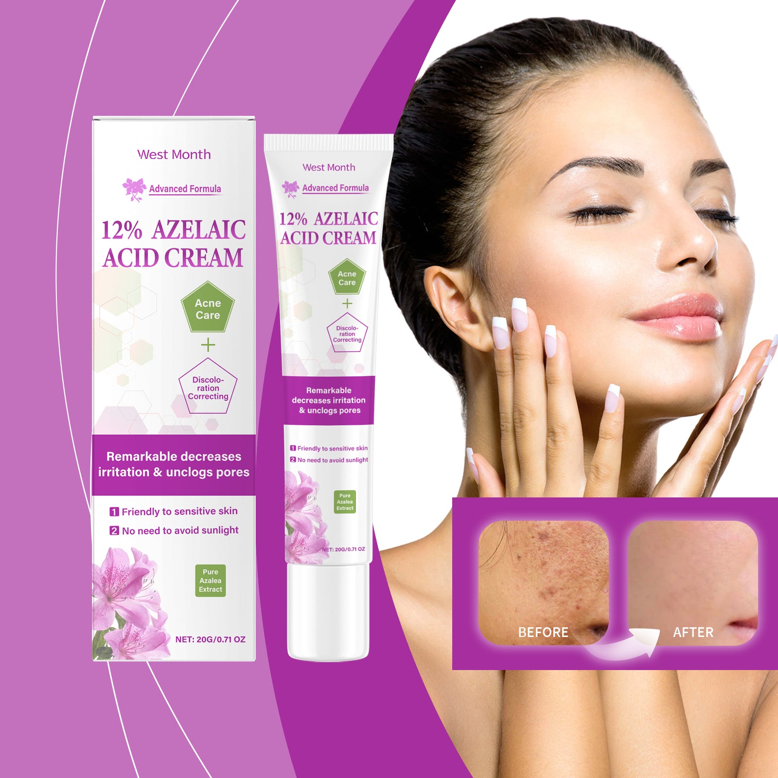 West&Month Azelaic Acid Cream