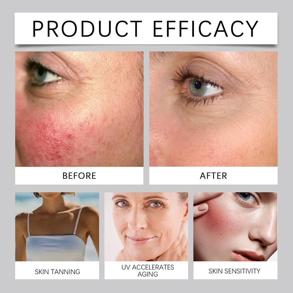 Hyaluronic Acid Skin Care Cream
